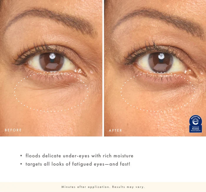 FarmHouse Fresh Eye'm Revived™ Total Renewal Cream