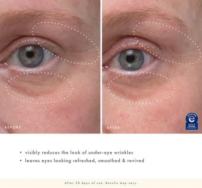 FarmHouse Fresh Eye'm Revived™ Total Renewal Cream